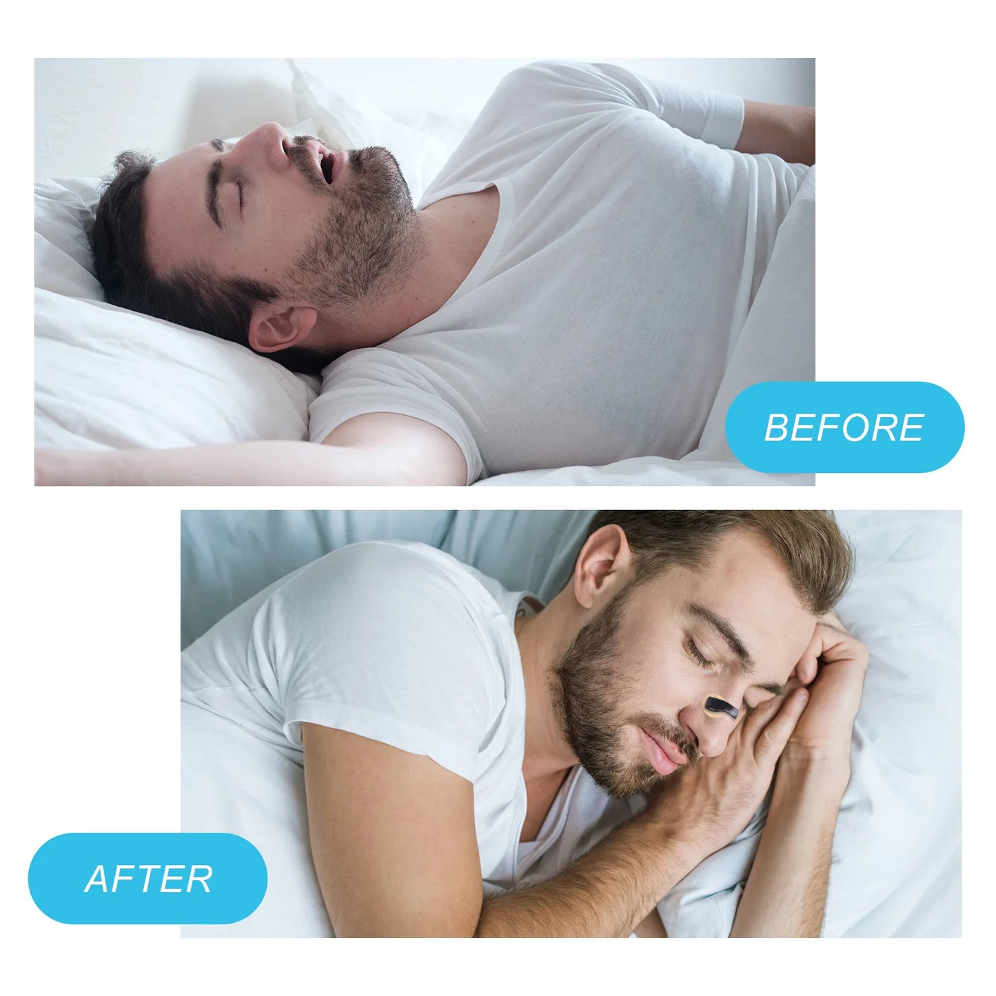 Box Nasal Breathing Dilators Starter Kits Magnetic Nose Strips Increase Sports Air Intake Improve Sleeping Reduce Snoring